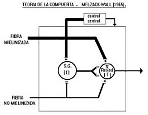 Figura 2. Esquema de la compuerta de Melzack y Wall.