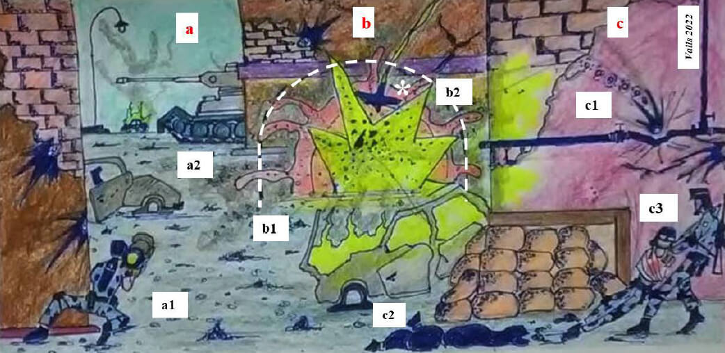 Figura 2a-c. Nuevos conceptos surgidos en la atención de heridos durante la invasión rusa a Ucrania. a) El binomio Tanque-
Antitanque aplicado por ambos bandos. a1) La confrontación se caracteriza por ser cerrada y violenta en las calles de las
ciudades ucranianas. a2) Los mecanismos de lesión por la explosión de armamento antitanque en vehículos blindados
incluyen traumatismos penetrantes y cerrados, por onda explosiva, por aceleración y desaceleración, quemaduras e inhalación
de vapores. b) Guerra de drones o vehículos aéreos no tripulados, en inglés “unmanned aerial vehicles” (UAV), usados
igualmente por ambos ejércitos, determinan varios tipos de heridas traumáticas. Asterisco blanco, dron armado impactado.
b1) Línea blanca punteada semicircular, onda explosiva. La onda por el efecto explosivo transmite su energía al herido. b2)
Quemadura por la explosión. Fragmentos de escombros voladores impactan en el lesionado, también ocasionan traumatismos
penetrantes por fragmentos o metralla del dispositivo aéreo. c) Trauma Urbano Moderno. c1) Las cañerías, las edificaciones
de concreto y el pavimento no absorben la energía cinética de las balas percutidas, ocasionando el rebote de los proyectiles
y su fragmentación, incrementando su poder destructivo. c2) La contaminación establece la necesidad de la administración
temprana de antibióticos. c3) Las múltiples construcciones, la presencia de barreras como escaleras y la proximidad de los
combatientes, dificulta la evacuación de los traumatizados. Las hemorragias en cuello han representado una de las principales
causas de deceso en conflictos urbanos.