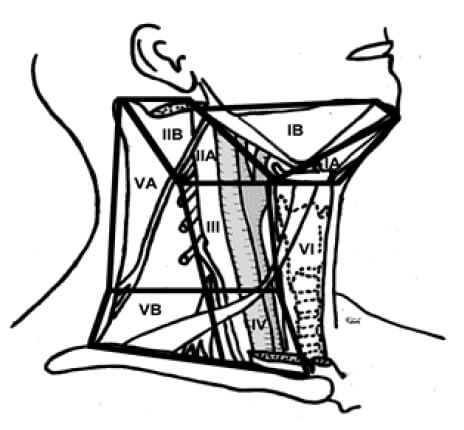 Figura 1. Se representa la división de los grupos ganglionares del cuello en niveles y subniveles