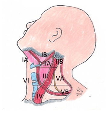 Figura 1. Sistema de clasificación por niveles ganglionares linfáticos cervicales del “Memorial Sloan-Kettering Cancer Center” (12,13). Esquema propio del autor.
