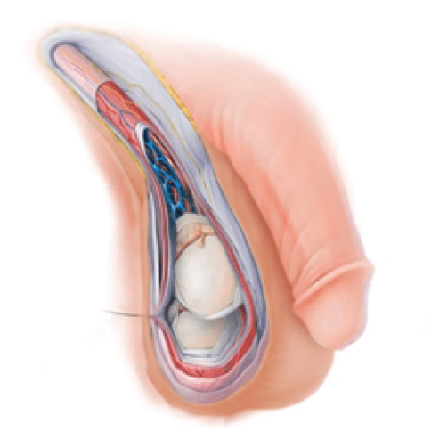 Figura 3. Ambos testículos en bolsa escrotal