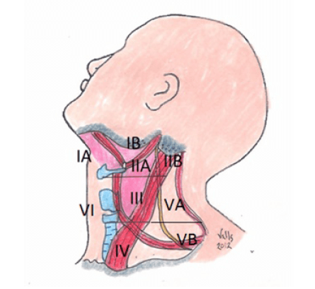 Figura 2. Sistema de clasificación por niveles ganglionares linfáticos cervicales del “Memorial Sloan-Kettering Cancer Center”. Esquema propio del autor.