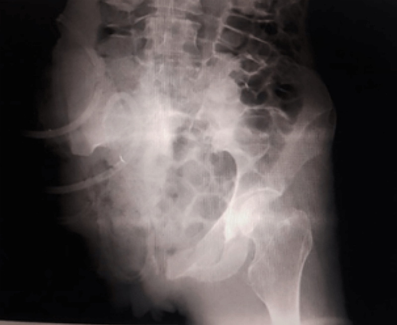 Imagen 9. Radiografía postoperatoria.